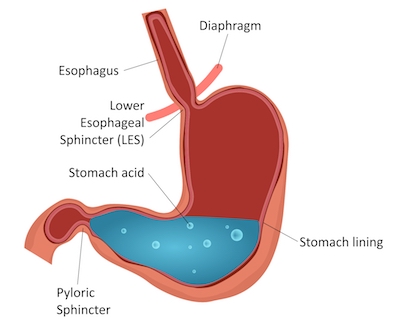 Stomach diagram and terms from Acid Reflux & Heartburn In 30 Minutes